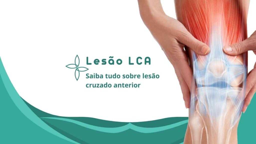 Lesão LCA tudo sobre lesão cruzado anterior