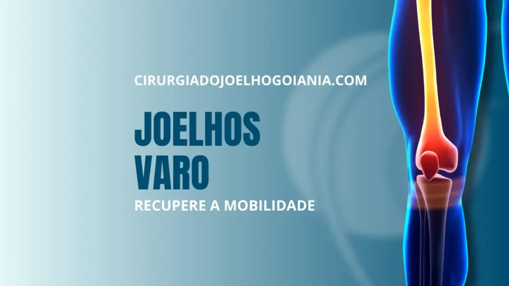joelhos varo