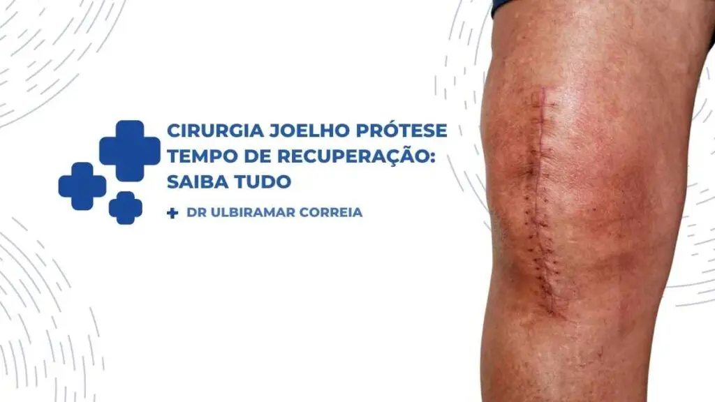 Cirurgia Joelho Prótese Tempo de Recuperação|