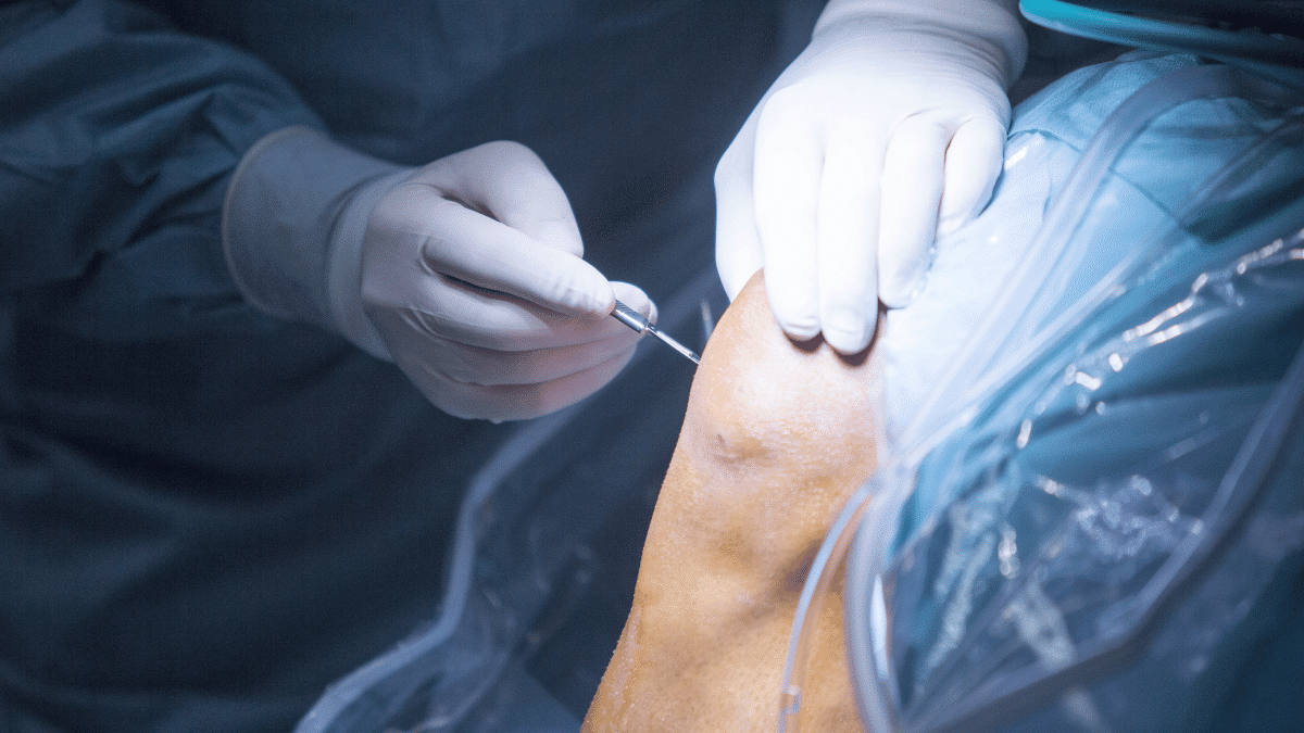 Cirurgia de menisco vale a pena