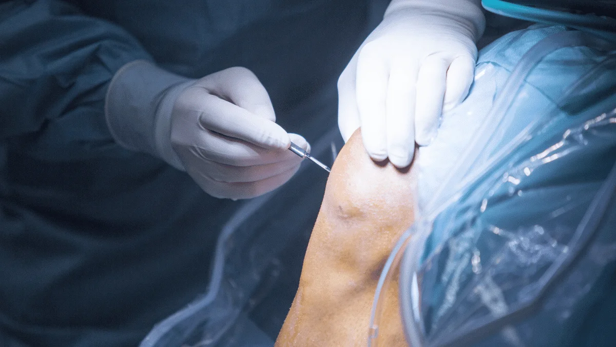 Cirurgia de menisco vale a pena