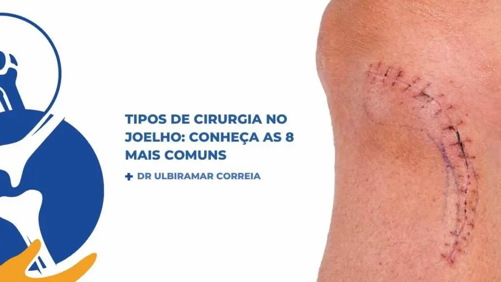 Cirurgia no Joelho||Cirurgia no Joelho