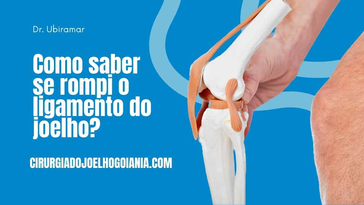 Como saber se rompi o ligamento do joelho