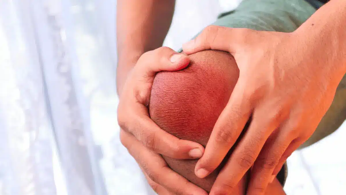 Condromatose sinovial no joelho