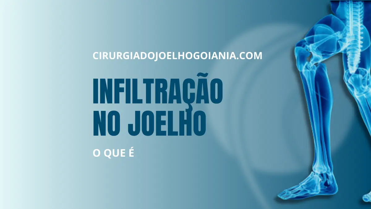 Infiltração no joelho|Infiltração no joelho