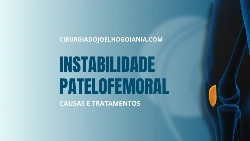 Instabilidade Patelofemoral|Instabilidade Patelofemoral