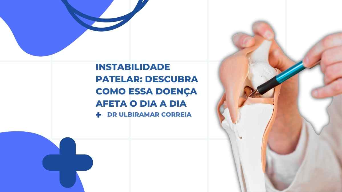 Instabilidade patelar|Instabilidade patelar|Como tratar instabilidade patelar|Qual tratamento para luxação patelar|O que um paciente com luxação de patela sente