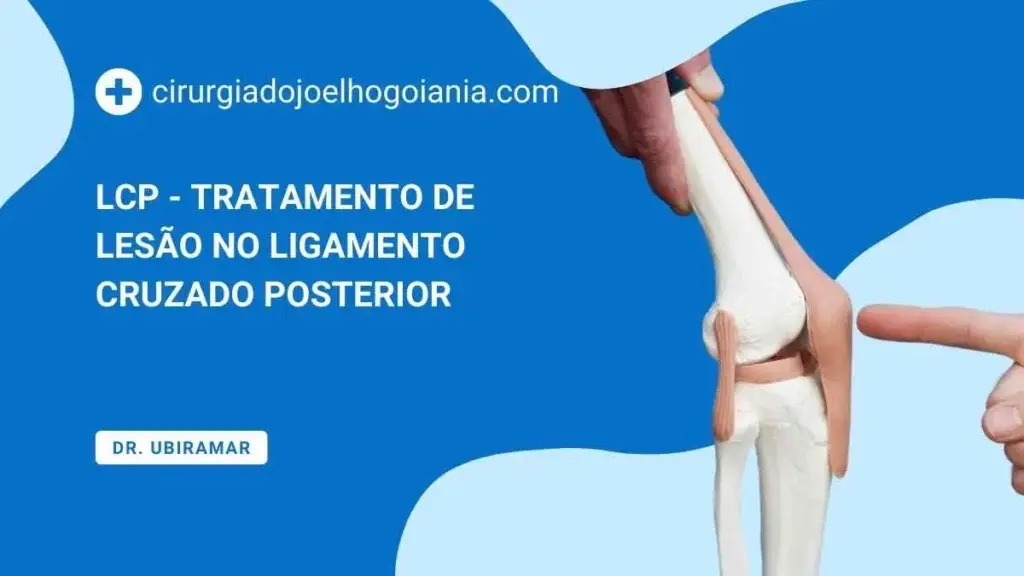 LCP - Tratamento de lesão no ligamento cruzado posterior||LCP - Tratamento de lesão no ligamento cruzado posterior