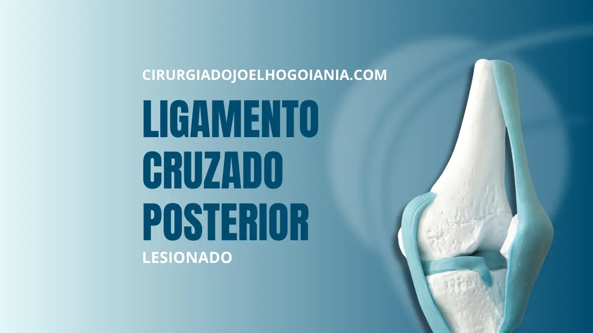 Lesão do Ligamento Cruzado Posterior