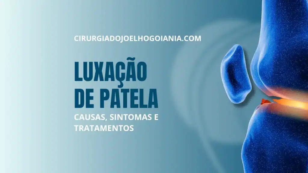 Luxação de Patela|
