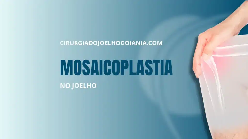 Mosaicoplastia no joelho|Mosaicoplastia no joelho