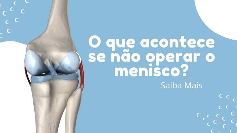 O que acontece se não operar o menisco Sempre é necessária cirurgia