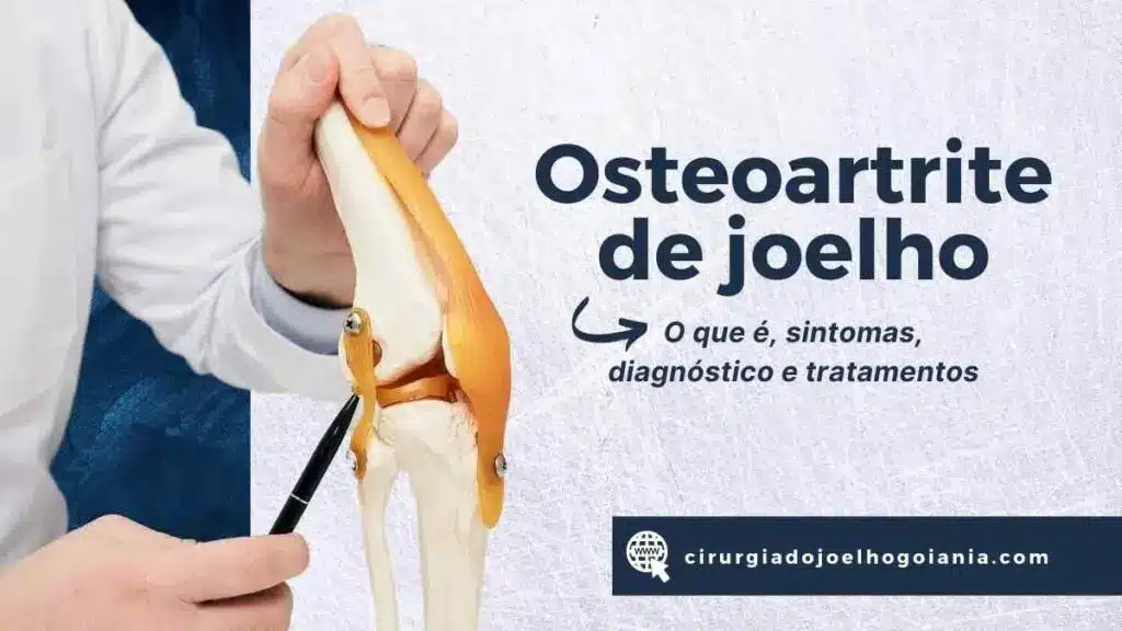 Osteoartrite de joelho|sintomas