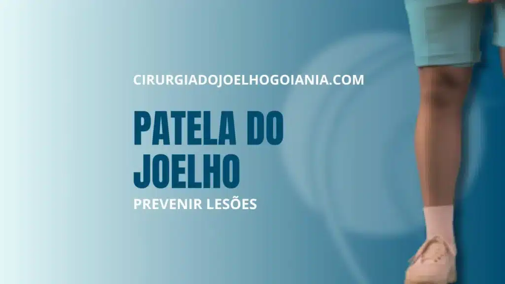 Patela do joelho||Patela do joelho