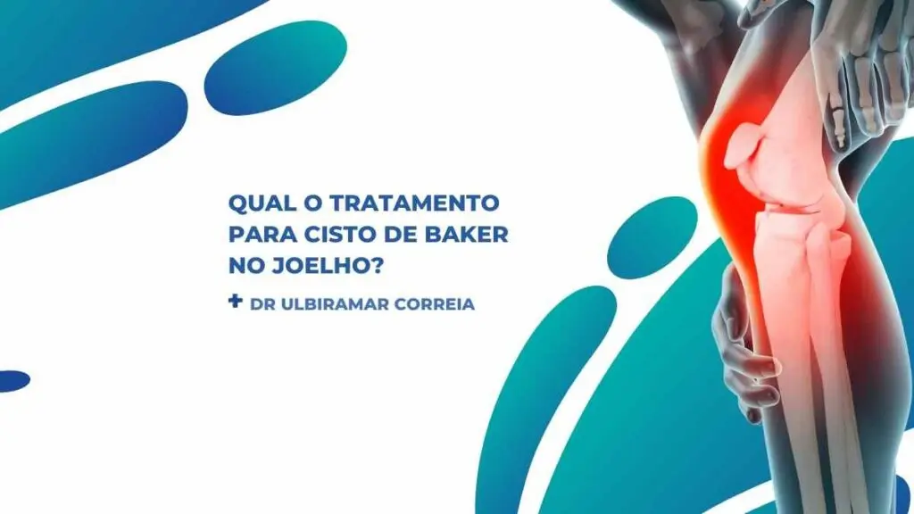 Qual tratamento cisto Baker joelho|