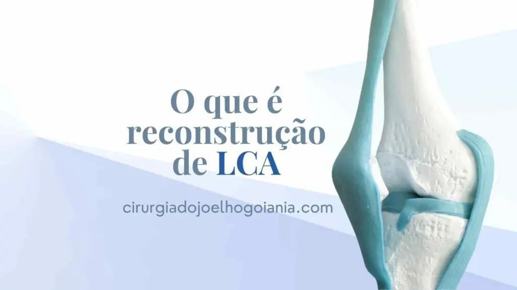 Reconstrução de LCA|