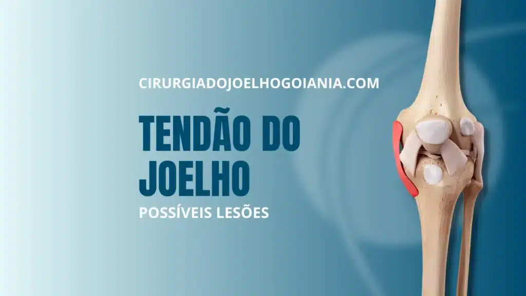 Tendão do joelho|Função e Possíveis Lesões|Ruptura do Tendão do Joelho Causas|Tendão do joelho