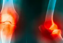 Articulações do joelho