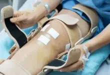 Cirurgia de LCA é tranquila