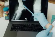 Lesões nos ligamentos do joelho