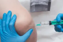 Quando fazer infiltração no joelho