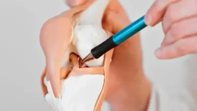 Ruptura completa do ligamento cruzado anterior precisa operar