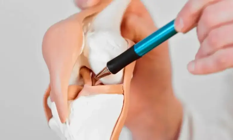 Ruptura completa do ligamento cruzado anterior precisa operar