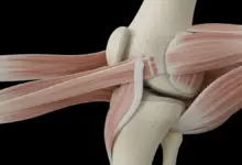 Ligamento femoropatelar medial