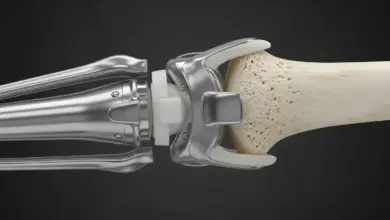 Quem tem prótese no joelho é considerado PCD