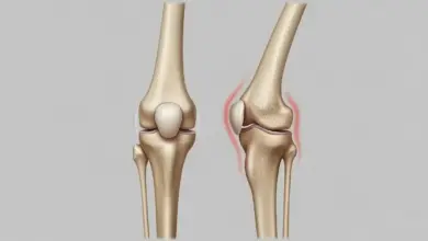 Osteotomia corretiva
