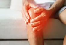 Condropatia patelar grau 4 aposenta