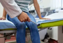 Dormência ao redor da cicatriz após cirurgia de joelho